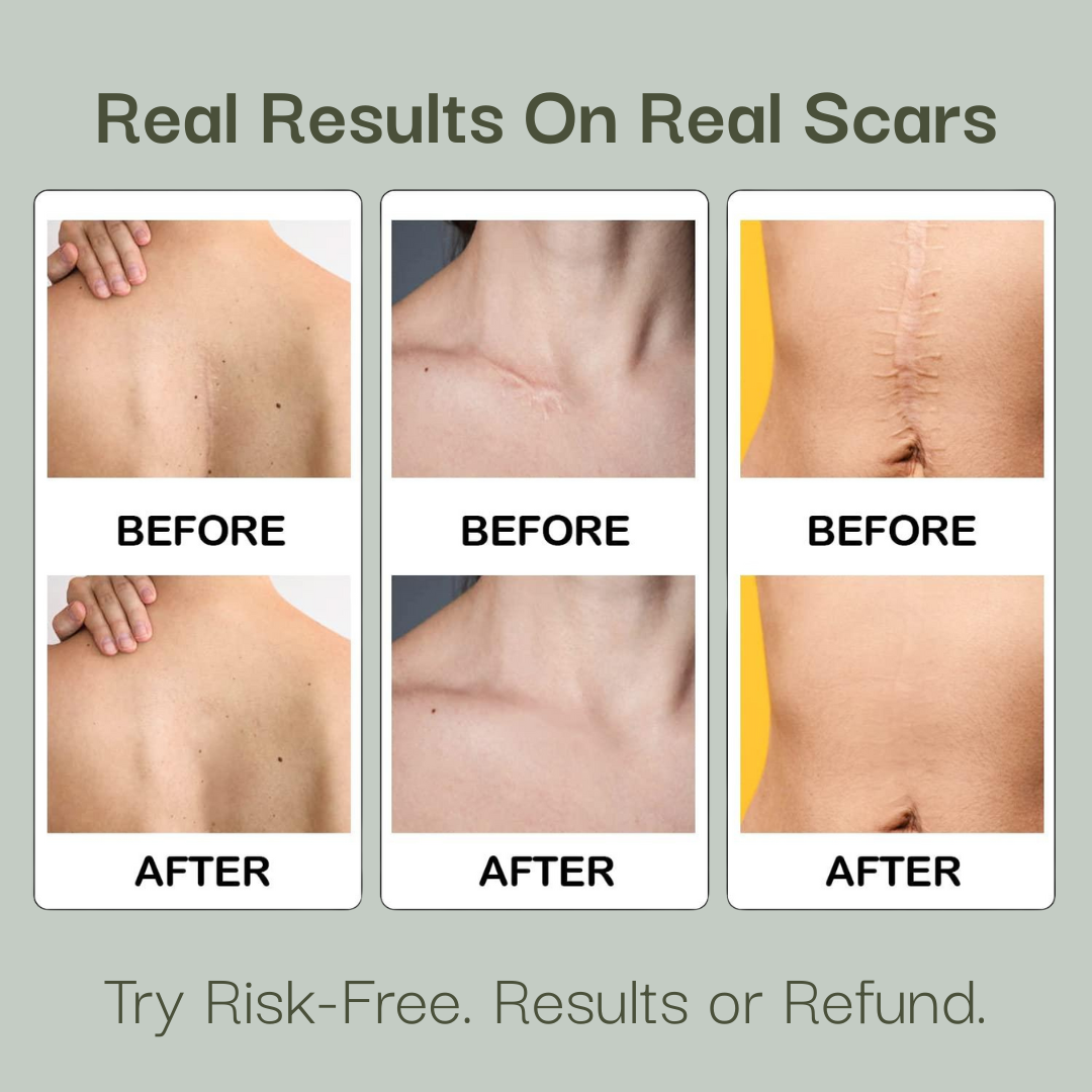 Helpful® Scar & Wrinkle Tape