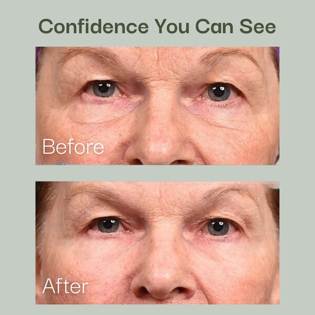 Helpful® Anti-Ageing Face Tape