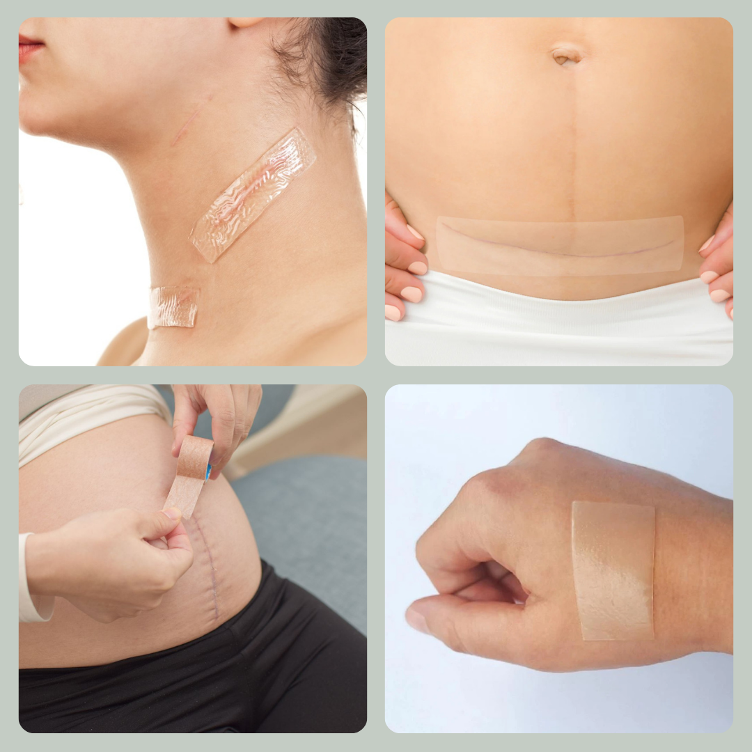 Helpful® Scar & Wrinkle Tape